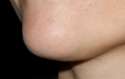 chin3.jpg