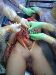 24727-full-autopsy-of-murdered-woman-that-was-rapedbig10.jpg