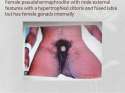 intersex-and-microscopic-identification-of-sex-23-638.jpg