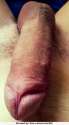 Dick.jpg
