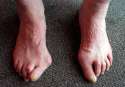 ugly_feet_1.jpg
