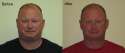 Weight-Loss-Before-and-After-31.jpg