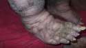 Foot6.jpg