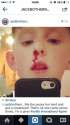 Nosebleed.jpg