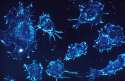 Wang-cancer-cell-NCI.jpg
