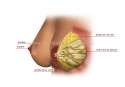 breast.jpg