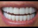 perfectteeth.jpg