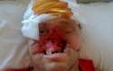 bear-easts-face-off-man-who-lives-33.jpg