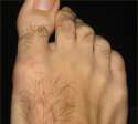 hairyfoot.jpg