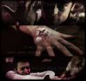 __this_is_a_chemical_burn___by_scootw91.jpg
