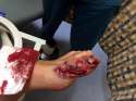 mow-lawn-flip-flops-lead-mangle-big-toe-1.jpg