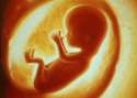 Fetus-2.jpg