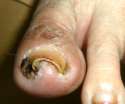 Foot.jpg