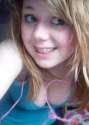 braces1_(10).jpg