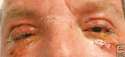 eyesmelt.gif