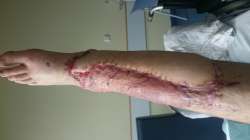 dis_is_my_leg_nokidding.jpg