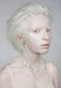 albino.png