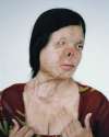 acid-attack-izabella-demavlys.jpg