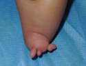 nubs2.jpg