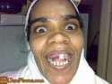 woman-with-bad-teeth1.jpg