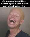 albino africans prove race is just about skin color.png