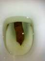 feces.jpg