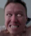 sunburn.jpg
