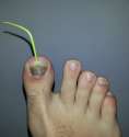 toothpick.jpg