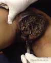 vulva-springs-forth-new-life-in-form-of-maggots-500x619.jpg