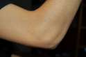 elbow.jpg