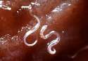 hookworm.jpg