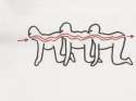 !Surgery_diagram.jpg