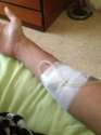 Karens arm.jpg