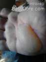 best-gore-member-huge-swollen-blister-01.jpg