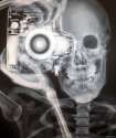 x-ray.jpg
