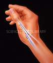P1640005-Artwork_of_tendons_in_human_thumb-SPL.jpg