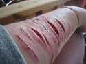 self harm (120).jpg