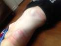 self harm (132).jpg