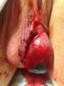 blood hang.jpg