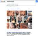 Bernie tattoo removal.jpg