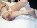 rotationplasty.jpg