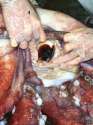 yes i did just google squid vagina and i know that this isn't a squid vagina but it still seems relevant to this topic.jpg
