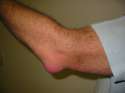 elblow enlargement.jpg