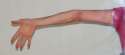 elbow_kink.jpg