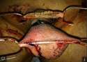 hooked n stapled.jpg
