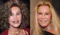 54eab143af0f8_-_03-botch-plastic-surgeries-jocelyn-wildenstein-lifestyle-1.jpg