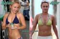 HaydenPanettierePlasticSurgery.jpg
