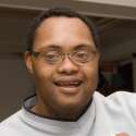 Down-syndrome 3.gif