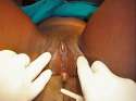 FGM-Victim.jpg