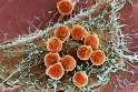 t-lymphocytes-and-cancer-cell-sem-spl.jpg